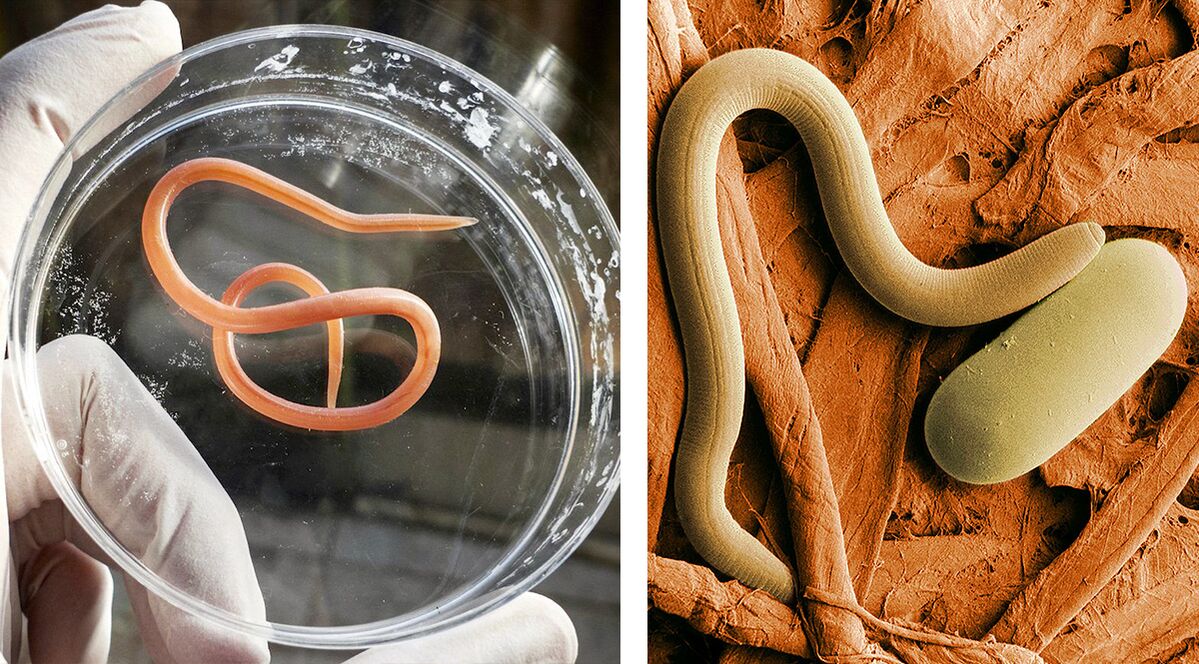 паразити в човешкото тяло