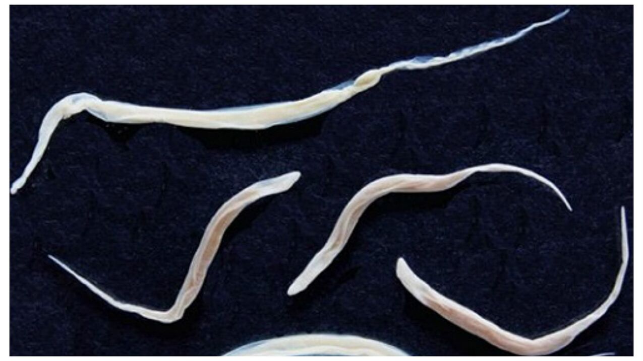 Pinworms са често срещани паразити, принадлежащи към групата на хелминтите.