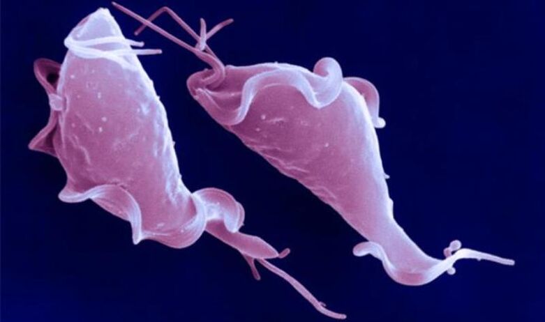 Trichomonas vaginalis е протозоен паразит, който причинява безплодие.